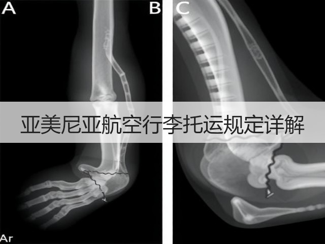 亚美尼亚航空行李托运规定详解(图2) 亚美尼亚航空行李托运规定详解(图2)