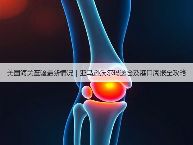 美国海关查验最新情况|亚马逊沃尔玛送仓及港口周报全攻略(图3) 美国海关查验最新情况|亚马逊沃尔玛送仓及港口周报全攻略(图3)