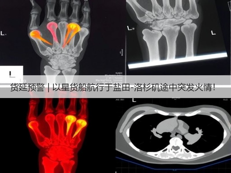 货延预警 | 以星货船航行于盐田-洛杉矶途中突发火情! 货延预警 | 以星货船航行于盐田-洛杉矶途中突发火情!