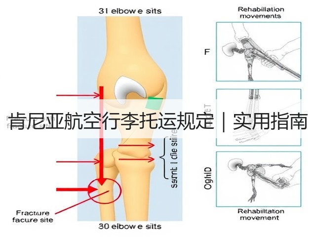 肯尼亚航空行李托运规定|实用指南(图2) 肯尼亚航空行李托运规定|实用指南(图2)