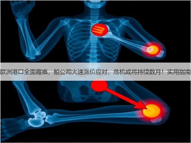 欧洲港口全面瘫痪,船公司火速涨价应对,危机或将持续数月!实用指南(图1) 欧洲港口全面瘫痪,船公司火速涨价应对,危机或将持续数月!实用指南(图1)