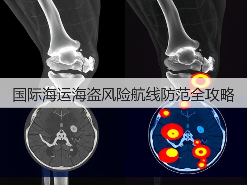 国际海运海盗风险航线防范全攻略