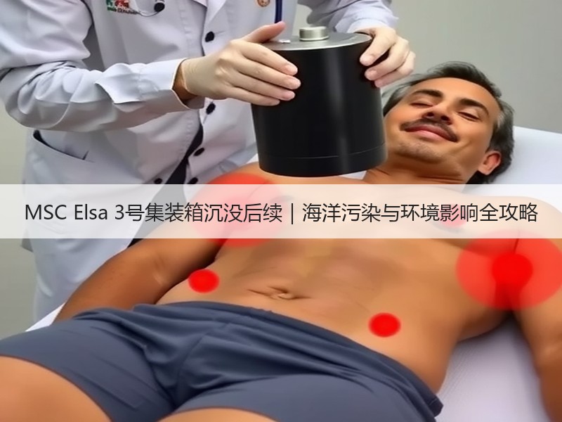 MSC Elsa 3号集装箱沉没后续|海洋污染与环境影响全攻略 MSC Elsa 3号集装箱沉没后续|海洋污染与环境影响全攻略