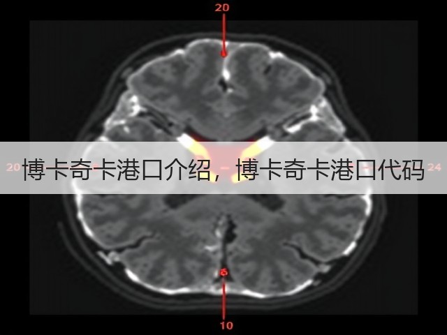 博卡奇卡港口介绍,博卡奇卡港口代码(图2) 博卡奇卡港口介绍,博卡奇卡港口代码(图2)