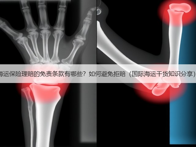 海运保险理赔的免责条款有哪些?如何避免拒赔(国际海运干货知识分享)(图1) 海运保险理赔的免责条款有哪些?如何避免拒赔(国际海运干货知识分享)(图1)