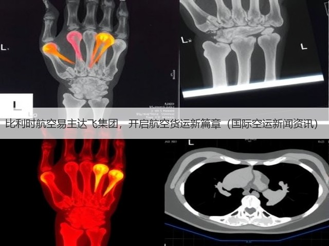 比利时航空易主达飞集团,开启航空货运新篇章(国际空运新闻资讯)(图1) 比利时航空易主达飞集团,开启航空货运新篇章(国际空运新闻资讯)(图1)